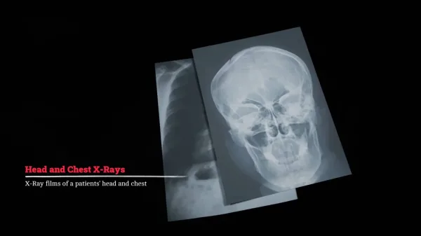 Silent Hill Townfall X-Ray Puzzle Guide: Skull and Chest Settings